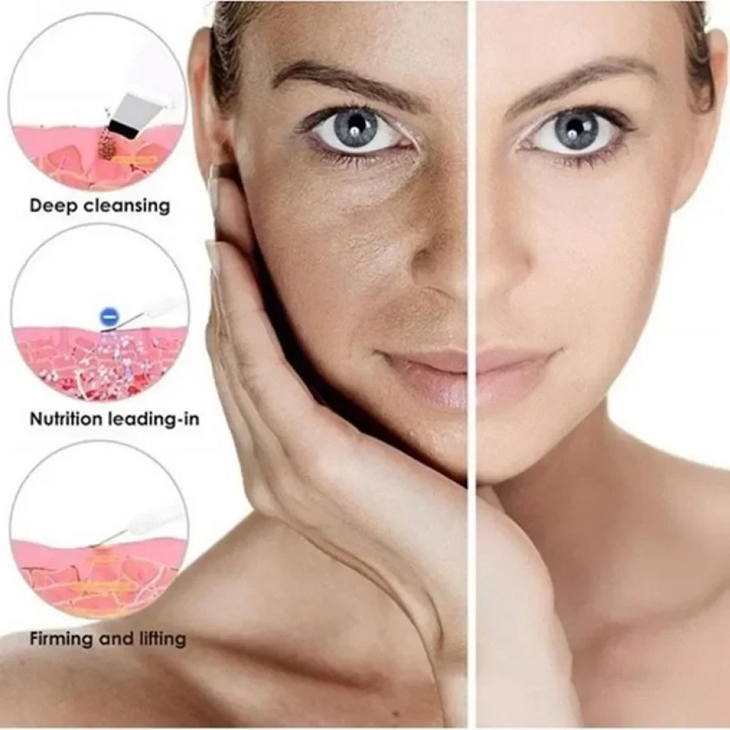 συσκευή-καθαρισμού,-απολέπισης-αναδόμησης-προσώπου-με-υπέρηχους